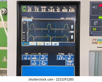 Melaka, Malaysia- Circa September 2022. The Display Screen Of Ventilator For Intubated Patient. Many Setting And Handle By Competency Persons. Photograph Contain Minimal Grain And Noise.  