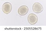 Melon (Cucumis melo) pollen grains under light microscope. Curcubitaceae pollen grains. 400x magnification + 2x camera zoom. Fresh sample. Selective focus image.