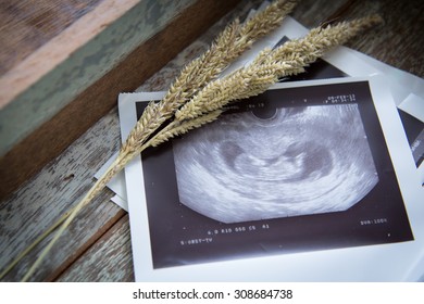 Memories Of Infant Baby Ultrasound Images In A Vintage Wooden Box