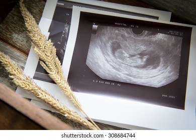 Memories Of Infant Baby Ultrasound Images In A Vintage Wooden Box