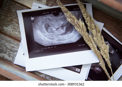 Memories Of Infant Baby Ultrasound Images In A Vintage Wooden Box