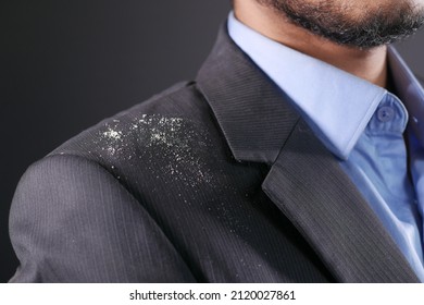 Men With Dandruff I On His Coat 