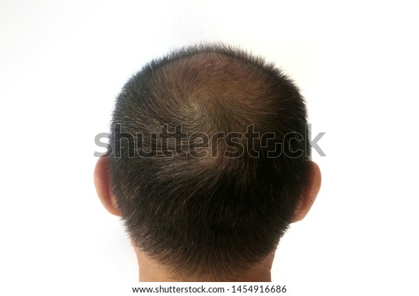 Men Have Black White Hair Thin Stock Photo Edit Now 1454916686