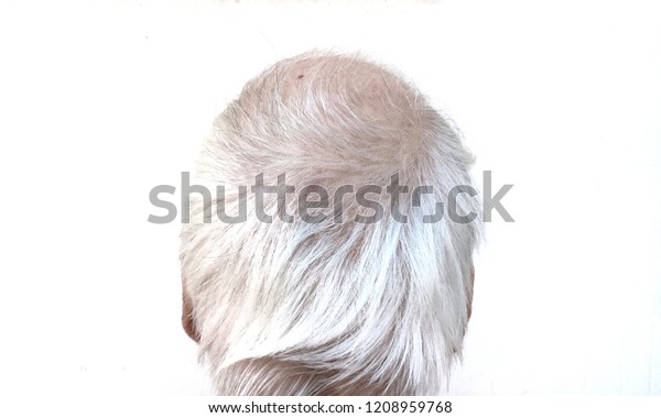 Men Have White Hair Thin Hair Stock Photo Edit Now 1208959768