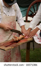 MENANDS - September 13: A Doctor Removes A Hand Of A Wonder Soldier During A Civil War Reenactment At The Albany Rural Cemetery On September 13, 2008 In Menands, NY.