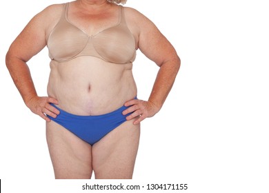 Menopausal woman with weight gain after brachioplasty, panniculectomy, abdominoplasty and mummy makeover. Full body front view hands on hips, copy space right. Makeover inspiration, faded  scars.