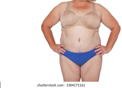 Menopausal woman with weight gain after brachioplasty, panniculectomy, abdominoplasty and mummy makeover. Full body front view hands on hips, copy space left. Makeover inspiration, faded  scars.