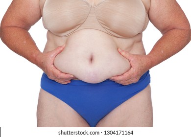 Menopausal woman with weight gain after brachioplasty, panniculectomy, abdominoplasty and mummy makeover. Full body front view hands holding excess abdominal weight, copy space right. Makeover inspire