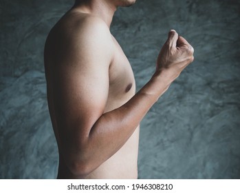 Men's Arms With Uneven Skin Tone Caused By Sunlight.