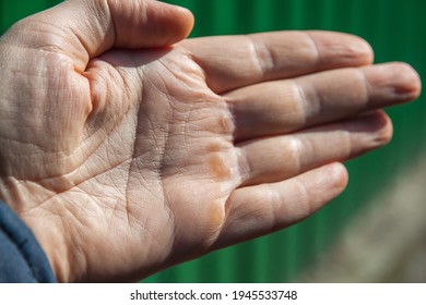 Men's calloused hands with clear lines of life and dry skin on a green background. Selective focus. Close-up