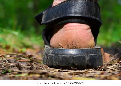 Men's foot with rough skin and a dry heel with many cracks. The concept of health problems, poor self-care. Monitor feet skin condition to prevent skin breakdown and trauma. Safefoot wear