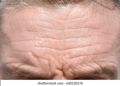 Men's Forehead Wrinkles And Grey Eyebrows