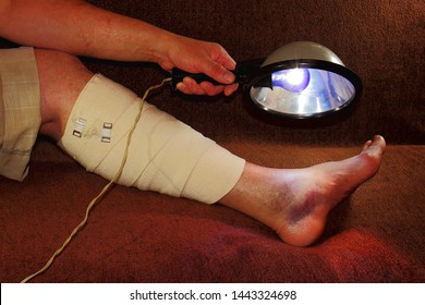 An Ankle Bruise Images, Stock Photos & Vectors | Shutterstock