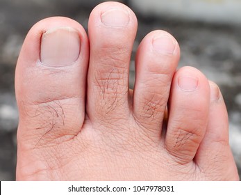 Men's Toes, Healthy Toe Nails