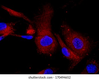 Mesenchymal Stem Cells Labeled With Fluorescence Molecules