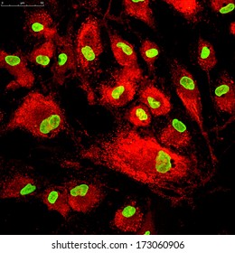 Mesenchymal Stem Cells Labeled With Fluorescence Molecules