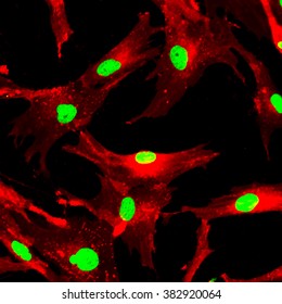 Mesenchymal Stem Cells Labeled With Fluorescent Molecules