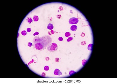 Gram Staining Known Grams Method Method Stock Photo 2080794424 ...