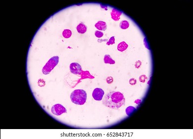 72 Pleural epithelial cells Images, Stock Photos & Vectors | Shutterstock