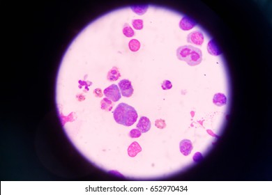 72 Pleural epithelial cells Images, Stock Photos & Vectors | Shutterstock