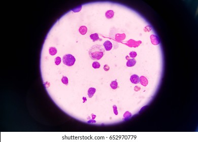 72 Pleural epithelial cells Images, Stock Photos & Vectors | Shutterstock