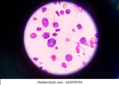 72 Pleural epithelial cells Images, Stock Photos & Vectors | Shutterstock