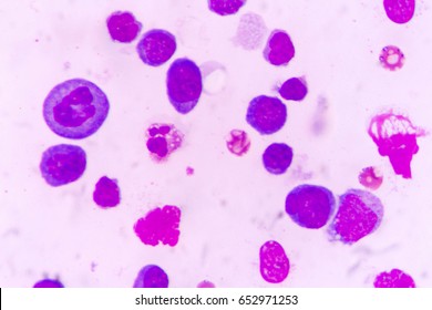 Mesothelial Hd Stock Images Shutterstock