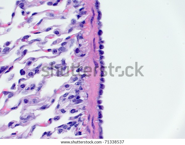 Mesothelium cells on lung\
surface