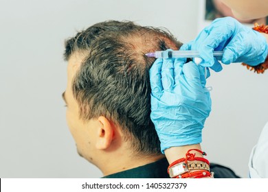 Mesotherapy Of Hair And Head. Injections In The Head. Fighting Hair Loss In Men. Men's Bald Spot In The Center Of The Head At The Crown. The Hands Of The Cosmetologist Trichologist And The Head