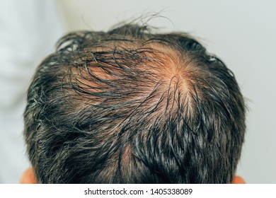 Hair Top Of Head Images Stock Photos Vectors Shutterstock