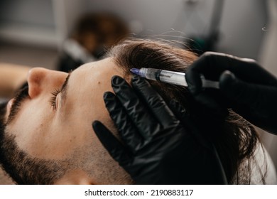 Mesotherapy. Injections with vitamins for hair growth on bald parts of the head in a young man - Shutterstock ID 2190883117