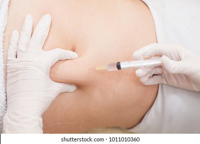 Mesotherapy Treatment On Woman's Body