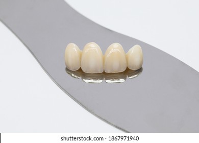 Metal free ceramic dental crowns.