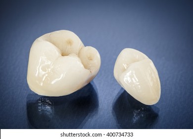 Metal Free Ceramic Dental Crowns