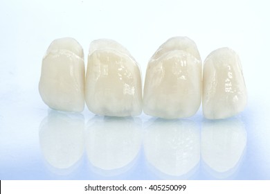 Metal Free Ceramic Dental Crowns