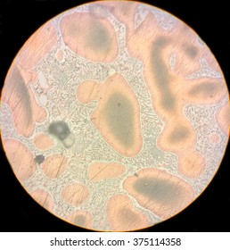 Metal Micrograph As Seen In A Microscope. URJC, Mostoles, Spain