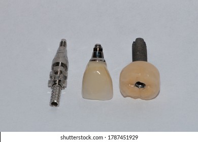 Metal-ceramic Crown On The Implant, Zirconium Dioxide Crown, Impression Transfer. Elements Of The Prosthesis For Implantation.