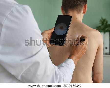 Method of dermatoscopy of skin formations and moles digital dermatoscope. Prevention of melanoma and skin cancer