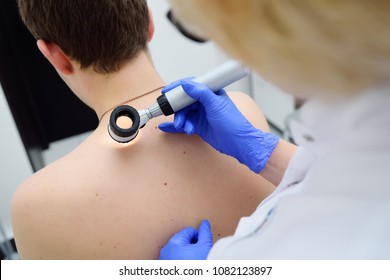 Method Of Dermatoscopy Of Skin Lesions And Moles. Preventing Melanoma And Skin Cancer