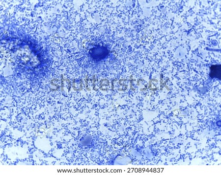 Methylene Blue Stained Micrograph of Mixed Bacterial Flora from a Human Fecal Smear Sample.