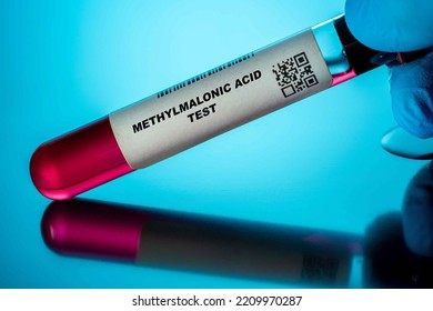 Methylmalonic Acid Test Blood Tests For Older Adults. Recommended Blood Test For The Elderly