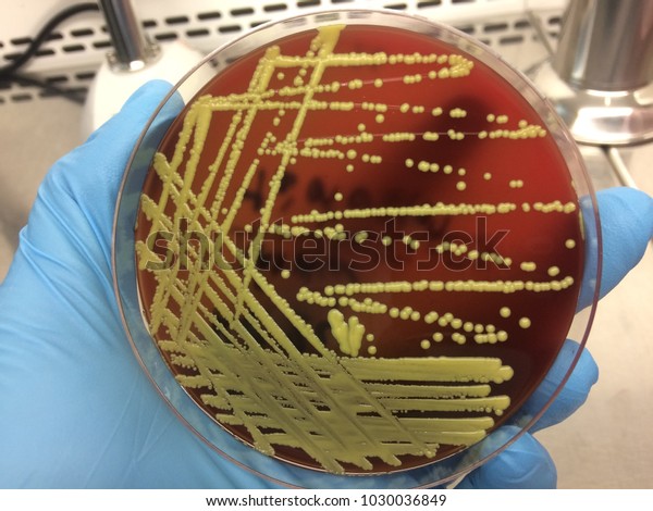 Micorcoccus luteus Bacteria\
Microbiology