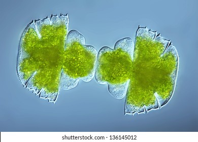Micrasterias truncata - algae - chlorophytes - desmidiacea - Desmid algae - DIC