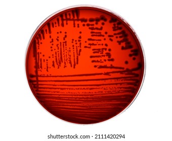 Microbial Culture Plate Of The Bacterium Enterobacter Cloacae, A Pathogenic Enterobacterium