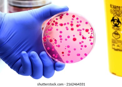 Microbiological Culture With Colonies Of Red Or Pink Bacteria And Yeasts