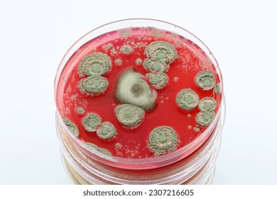 Microbiological culture plates with fungal colonies