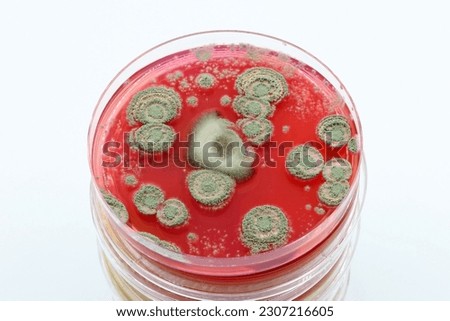 Microbiological culture plates with fungal colonies Foto d'archivio © 