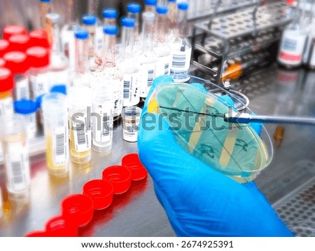 Microbiological inoculation loop being sterilized in flame of alcohol Bunsen burner on a table in Laboratory.