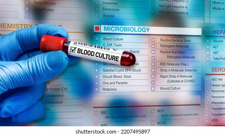 Microbiologist With Blood Tube For Culture And Microbiological Digital Tests Petition Form For Microbiology Lab. Doctor Holding Blood Sample Tube For Analysis And Background Microbiology Test Request