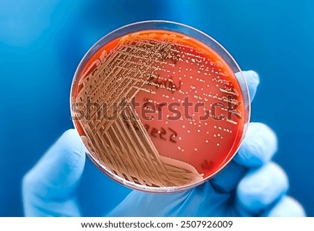 Microbiologist holding petri dish with colony of Raoultella ornithinolytica bacteria, gram-negative bacterium.